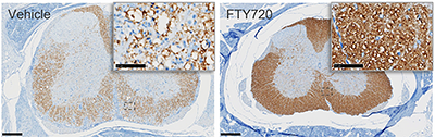 EAE IHC MBP staining